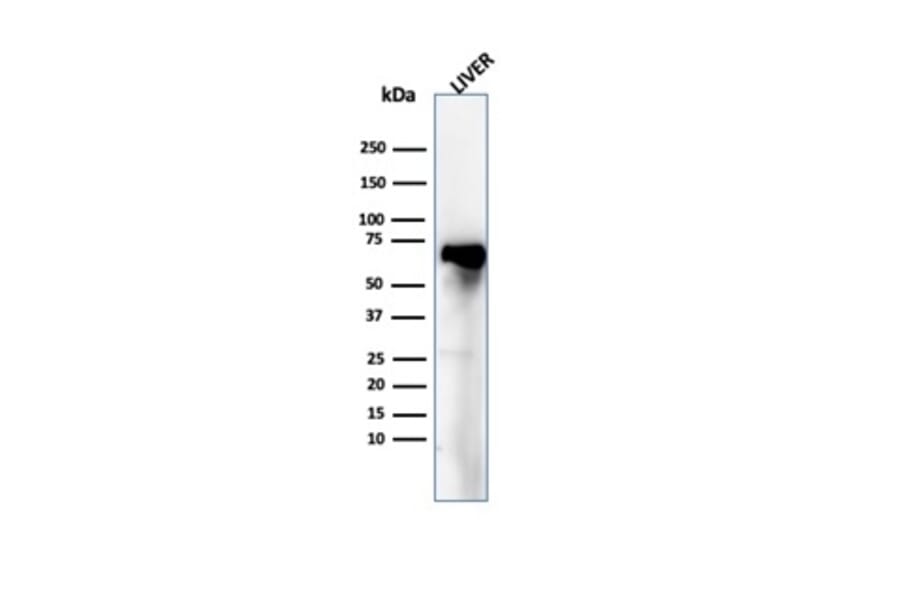 Western Blot - Anti-Albumin Antibody [ALB/6409R] - BSA and Azide free (A251687) - Antibodies.com