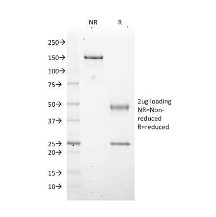 SDS-PAGE - Anti-EZH2 Antibody [EZH2/2536] - BSA and Azide free (A251688) - Antibodies.com