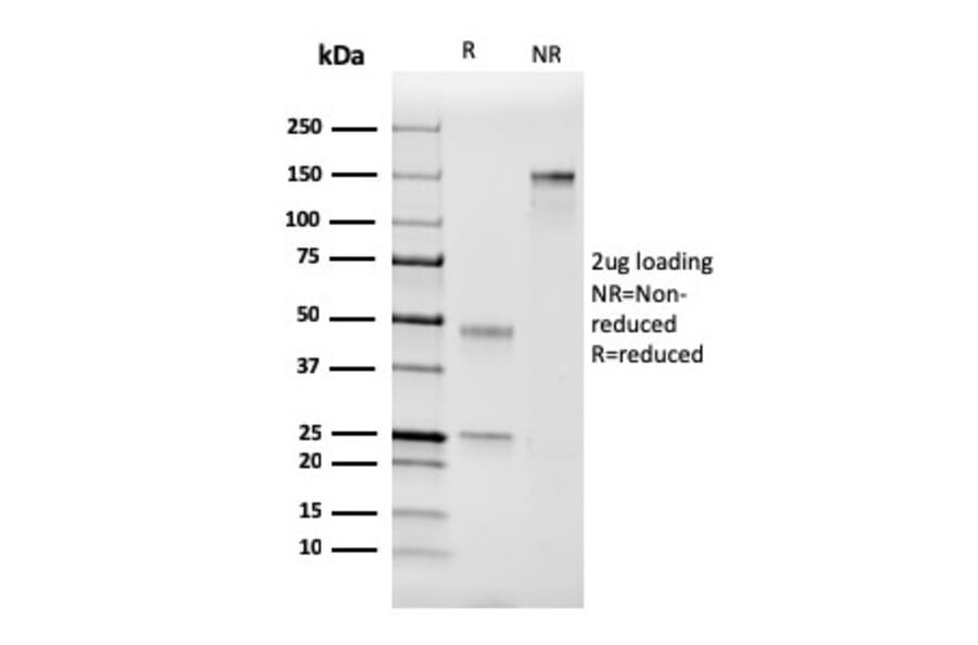 SDS-PAGE - Anti-Coagulation Factor VII Antibody [F7/3511] - BSA and Azide free (A251689) - Antibodies.com