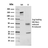 SDS-PAGE - Anti-Coagulation Factor VII Antibody [F7/3513] - BSA and Azide free (A251690) - Antibodies.com