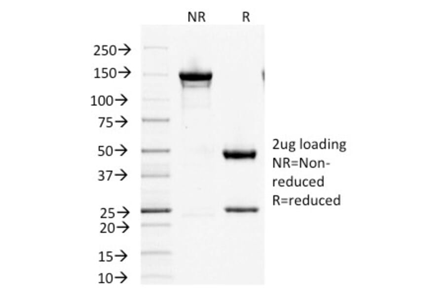 SDS-PAGE - Anti-Factor XIIIa Antibody [F13A1/1447] - BSA and Azide free (A251692) - Antibodies.com
