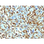 Immunohistochemistry - Anti-Factor XIIIa Antibody [F13A1/1448] - BSA and Azide free (A251694) - Antibodies.com