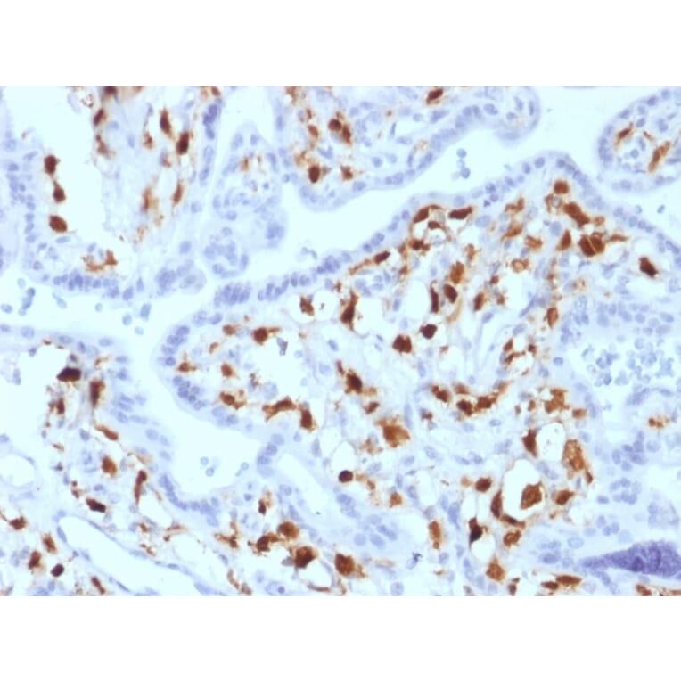Immunohistochemistry - Anti-Factor XIIIa Antibody [SPM180] - BSA and Azide free (A251694) - Antibodies.com
