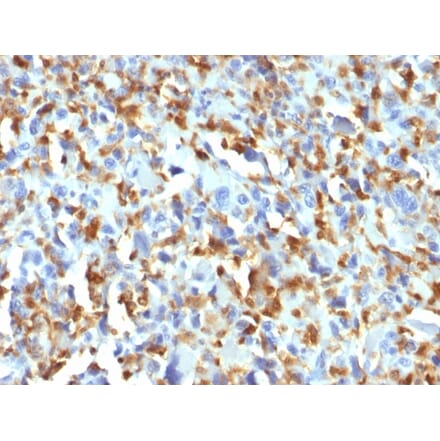 Immunohistochemistry - Anti-Factor XIIIa Antibody [F13A1/1683] - BSA and Azide free (A251696) - Antibodies.com