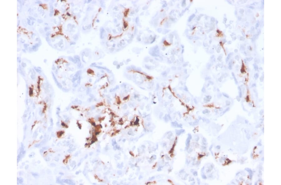Immunohistochemistry - Anti-Factor XIIIa Antibody [F13A1/3772R] - BSA and Azide free (A251697) - Antibodies.com