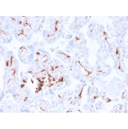 Immunohistochemistry - Anti-Factor XIIIa Antibody [F13A1/3772R] - BSA and Azide free (A251697) - Antibodies.com