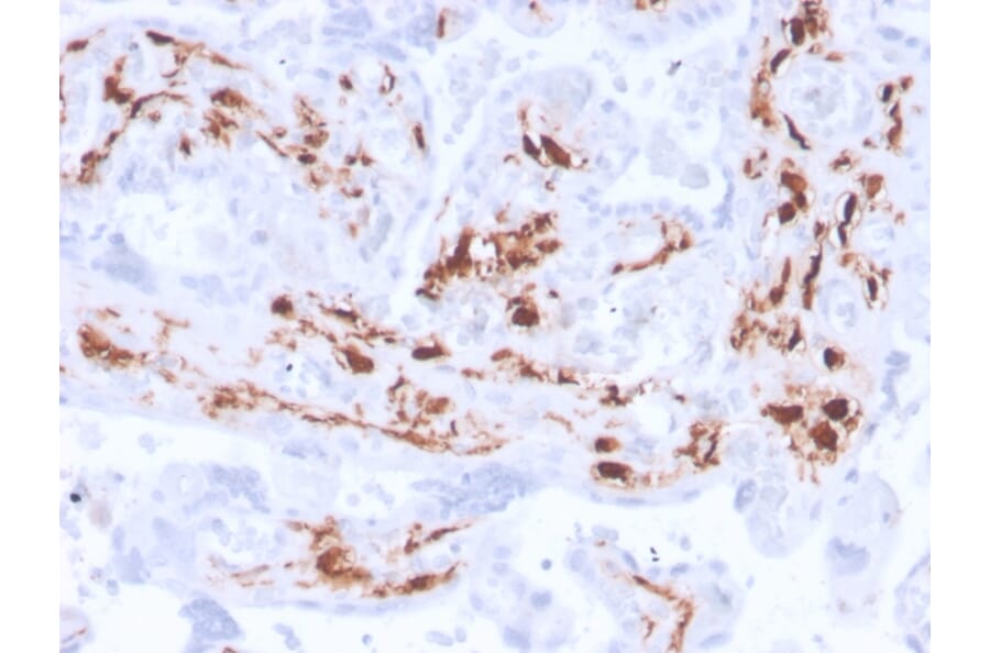 Immunohistochemistry - Anti-Factor XIIIa Antibody [F13A1/3772R] - BSA and Azide free (A251696) - Antibodies.com