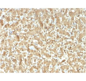 Immunohistochemistry - Anti-FABP1 Antibody [FABP1/3482] - BSA and Azide free (A251698) - Antibodies.com