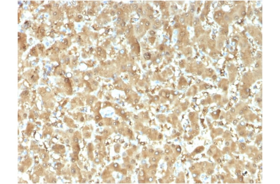 Immunohistochemistry - Anti-FABP1 Antibody [FABP1/3482] - BSA and Azide free (A251698) - Antibodies.com
