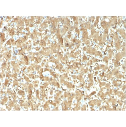 Immunohistochemistry - Anti-FABP1 Antibody [FABP1/3482] - BSA and Azide free (A251698) - Antibodies.com