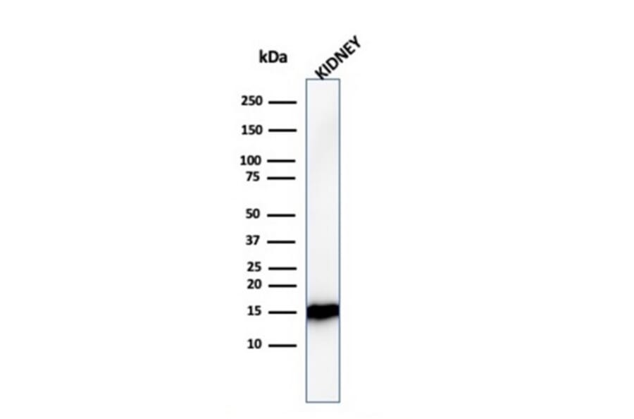 Western Blot - Anti-FABP1 Antibody [FABP1/3482] - BSA and Azide free (A251698) - Antibodies.com