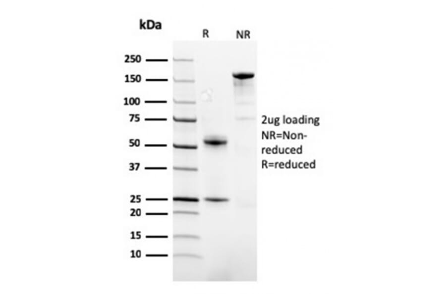 SDS-PAGE - Anti-FABP1 Antibody [FABP1/3482] - BSA and Azide free (A251698) - Antibodies.com