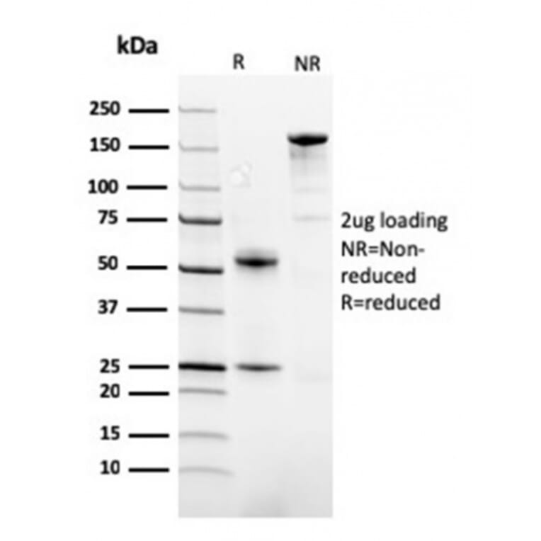 SDS-PAGE - Anti-FABP1 Antibody [FABP1/3482] - BSA and Azide free (A251698) - Antibodies.com