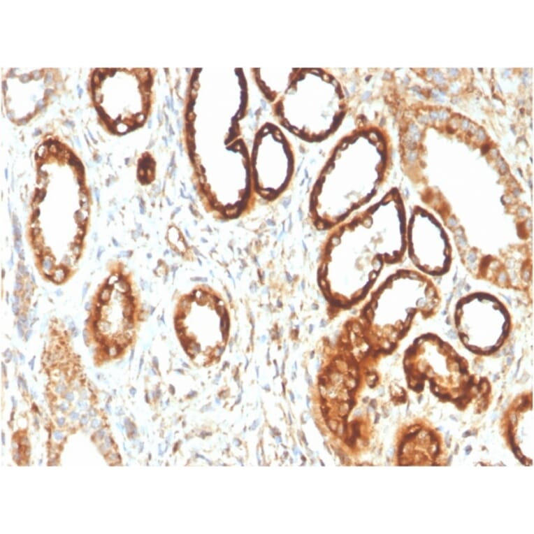 Immunohistochemistry - Anti-FABP1 Antibody [FABP1/3483] - BSA and Azide free (A251699) - Antibodies.com