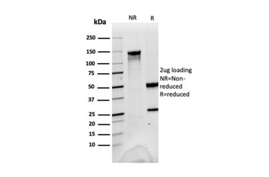 SDS-PAGE - Anti-FABP1 Antibody [FABP1/3483] - BSA and Azide free (A251699) - Antibodies.com
