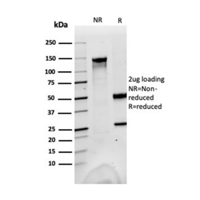 SDS-PAGE - Anti-FABP1 Antibody [FABP1/3483] - BSA and Azide free (A251699) - Antibodies.com