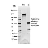 SDS-PAGE - Anti-FABP1 Antibody [FABP1/3483] - BSA and Azide free (A251699) - Antibodies.com