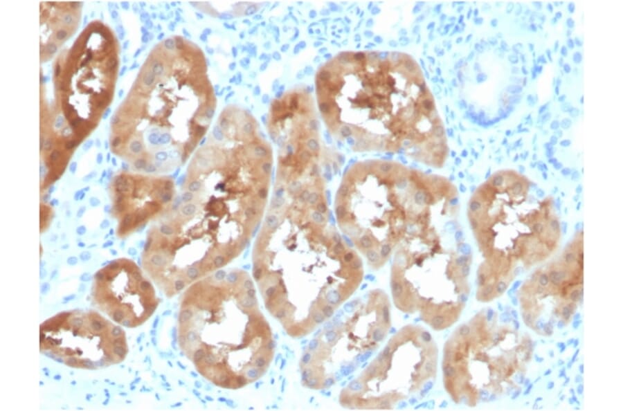 Immunohistochemistry - Anti-FABP1 Antibody [FABP1/3484] - BSA and Azide free (A251700) - Antibodies.com