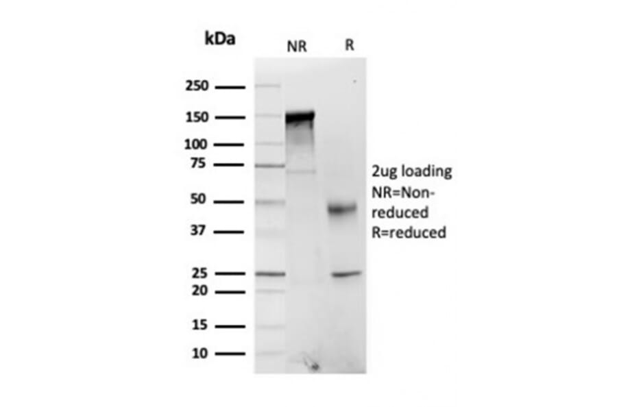 SDS-PAGE - Anti-FABP1 Antibody [FABP1/3484] - BSA and Azide free (A251700) - Antibodies.com