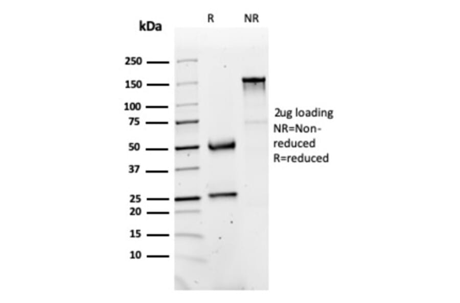 SDS-PAGE - Anti-FABP1 Antibody [FABP1/3486] - BSA and Azide free (A251701) - Antibodies.com