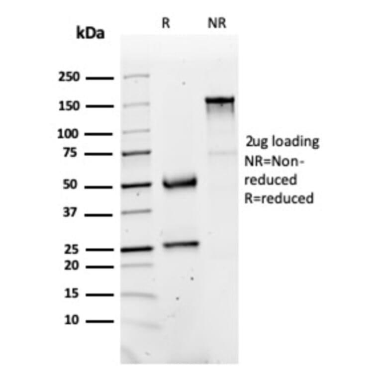 SDS-PAGE - Anti-FABP1 Antibody [FABP1/3486] - BSA and Azide free (A251701) - Antibodies.com