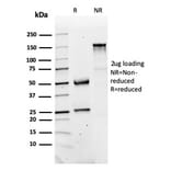 SDS-PAGE - Anti-FABP1 Antibody [FABP1/3486] - BSA and Azide free (A251701) - Antibodies.com