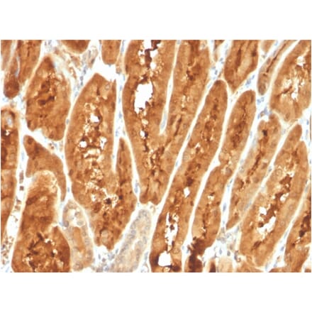 Immunohistochemistry - Anti-FABP1 Antibody [FABP1/3487] - BSA and Azide free (A251702) - Antibodies.com