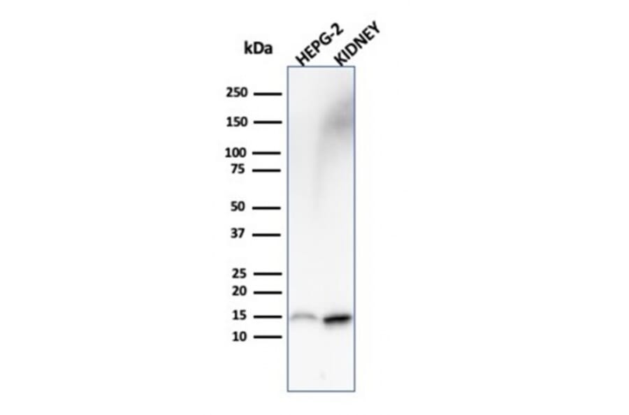 Western Blot - Anti-FABP1 Antibody [FABP1/3487] - BSA and Azide free (A251702) - Antibodies.com