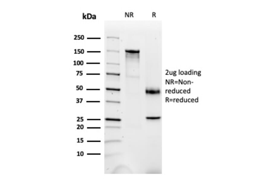 SDS-PAGE - Anti-FABP1 Antibody [FABP1/3487] - BSA and Azide free (A251702) - Antibodies.com