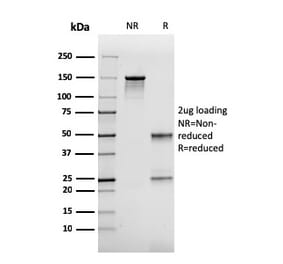 SDS-PAGE - Anti-FABP2 Antibody [CPTC-FABP2-3] - BSA and Azide free (A251702) - Antibodies.com