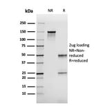SDS-PAGE - Anti-FABP2 Antibody [CPTC-FABP2-3] - BSA and Azide free (A251702) - Antibodies.com