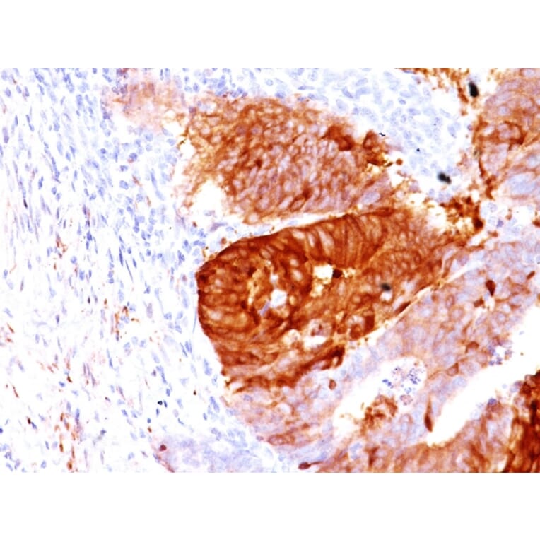 Immunohistochemistry - Anti-ALDH1A1 Antibody [ALDH1A1/1381] - BSA and Azide free (A251703) - Antibodies.com