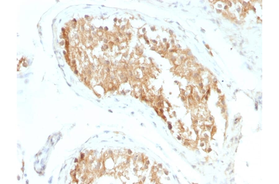 Immunohistochemistry - Anti-ALDH1A1 Antibody [ALDH1A1/1381] - BSA and Azide free (A251704) - Antibodies.com