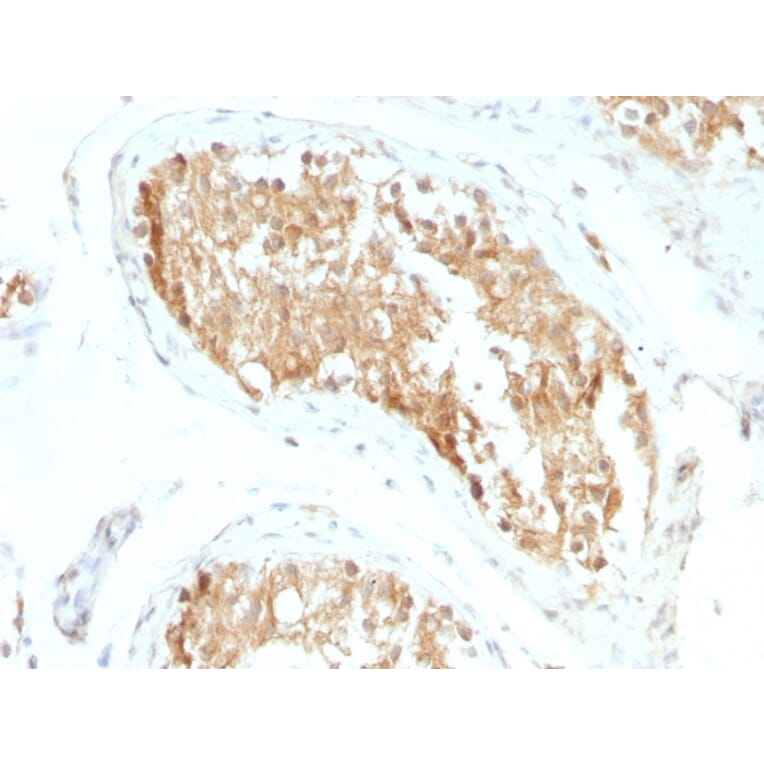 Immunohistochemistry - Anti-ALDH1A1 Antibody [ALDH1A1/1381] - BSA and Azide free (A251704) - Antibodies.com