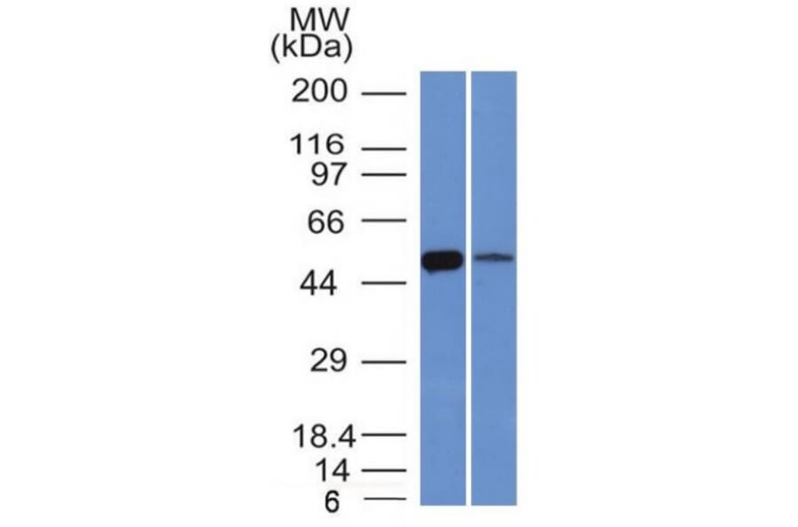 Western Blot - Anti-ALDH1A1 Antibody [ALDH1A1/1381] - BSA and Azide free (A251704) - Antibodies.com