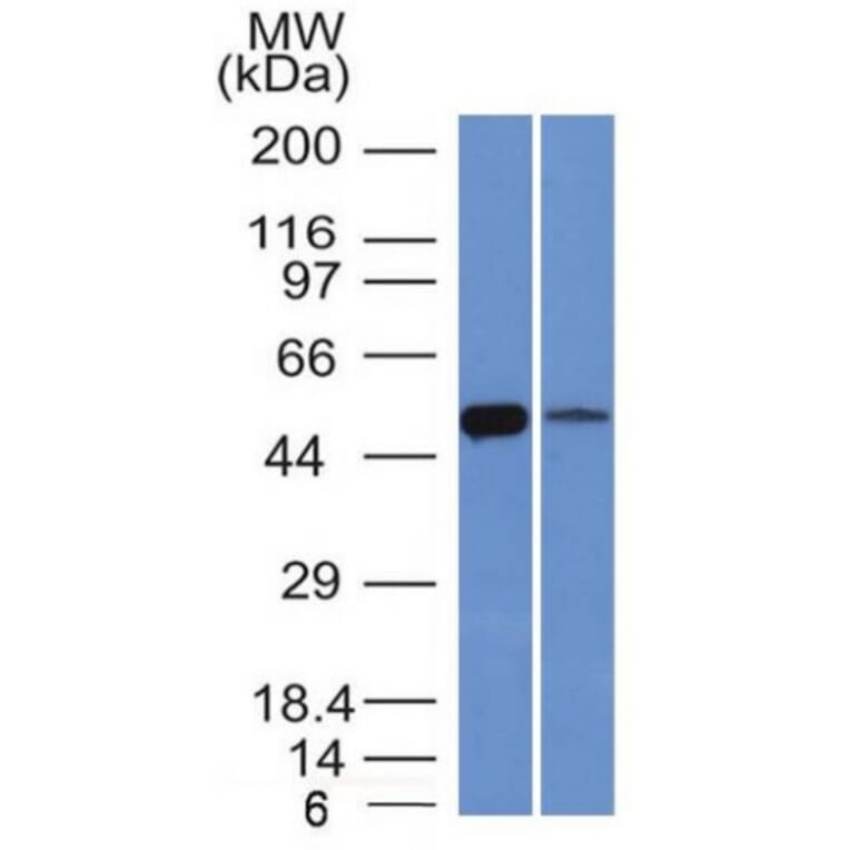 Western Blot - Anti-ALDH1A1 Antibody [ALDH1A1/1381] - BSA and Azide free (A251704) - Antibodies.com