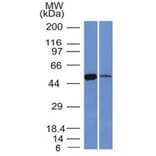 Western Blot - Anti-ALDH1A1 Antibody [ALDH1A1/1381] - BSA and Azide free (A251704) - Antibodies.com