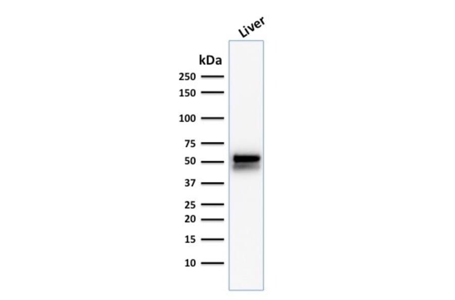 Western Blot - Anti-ALDH1A1 Antibody [ALDH1A1/1381] - BSA and Azide free (A251704) - Antibodies.com