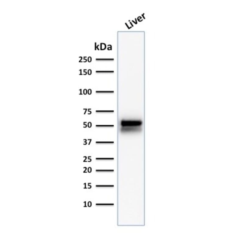 Western Blot - Anti-ALDH1A1 Antibody [ALDH1A1/1381] - BSA and Azide free (A251704) - Antibodies.com