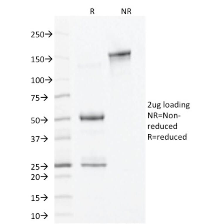 SDS-PAGE - Anti-ALDH1A1 Antibody [ALDH1A1/1381] - BSA and Azide free (A251704) - Antibodies.com