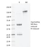 SDS-PAGE - Anti-ALDH1A1 Antibody [ALDH1A1/1381] - BSA and Azide free (A251704) - Antibodies.com