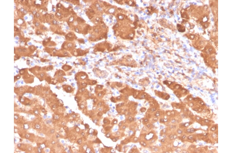 Immunohistochemistry - Anti-ALDH1A1 Antibody [ALDH1A1/4793] - BSA and Azide free (A251705) - Antibodies.com