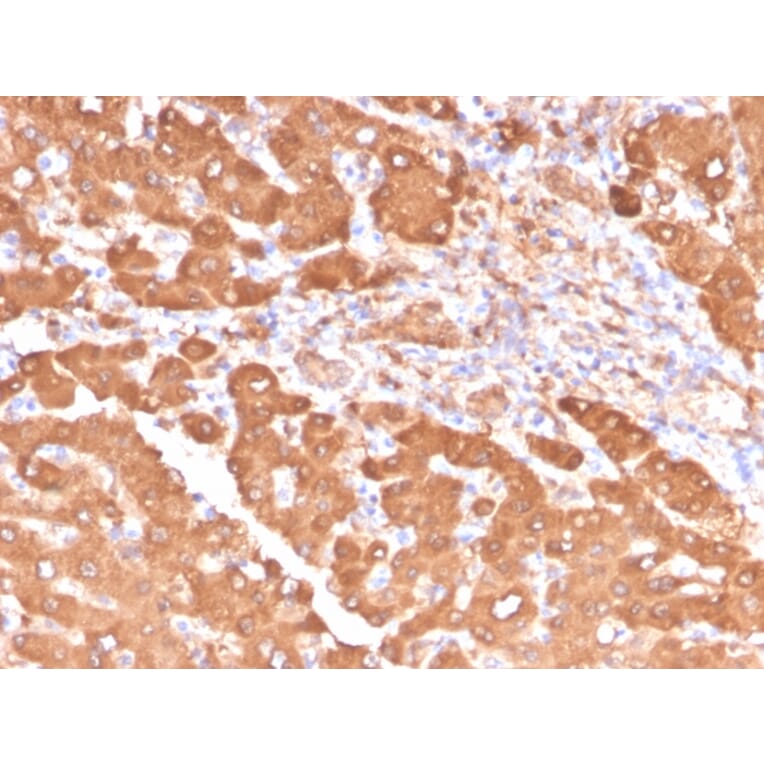 Immunohistochemistry - Anti-ALDH1A1 Antibody [ALDH1A1/4793] - BSA and Azide free (A251705) - Antibodies.com