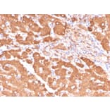 Immunohistochemistry - Anti-ALDH1A1 Antibody [ALDH1A1/4793] - BSA and Azide free (A251705) - Antibodies.com