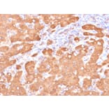 Immunohistochemistry - Anti-ALDH1A1 Antibody [ALDH1A1/4793] - BSA and Azide free (A251705) - Antibodies.com