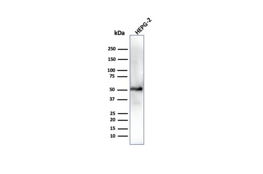 Western Blot - Anti-ALDH1A1 Antibody [ALDH1A1/4793] - BSA and Azide free (A251705) - Antibodies.com