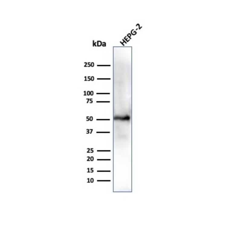 Western Blot - Anti-ALDH1A1 Antibody [ALDH1A1/4793] - BSA and Azide free (A251705) - Antibodies.com