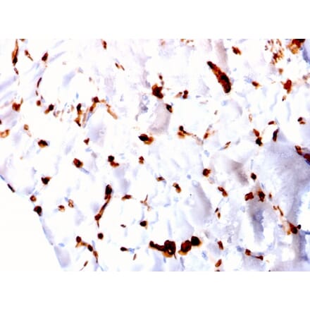 Immunohistochemistry - Anti-FABP5 Antibody [CPTC-FABP5-3] - BSA and Azide free (A251706) - Antibodies.com