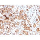 Immunohistochemistry - Anti-FABP5 Antibody [CPTC-FABP5-3] - BSA and Azide free (A251705) - Antibodies.com