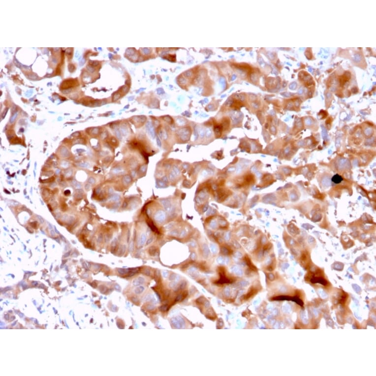 Immunohistochemistry - Anti-FABP5 Antibody [FABP5/3750] - BSA and Azide free (A251707) - Antibodies.com